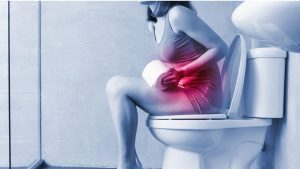 How to Manage Constipation After Gastric Sleeeve